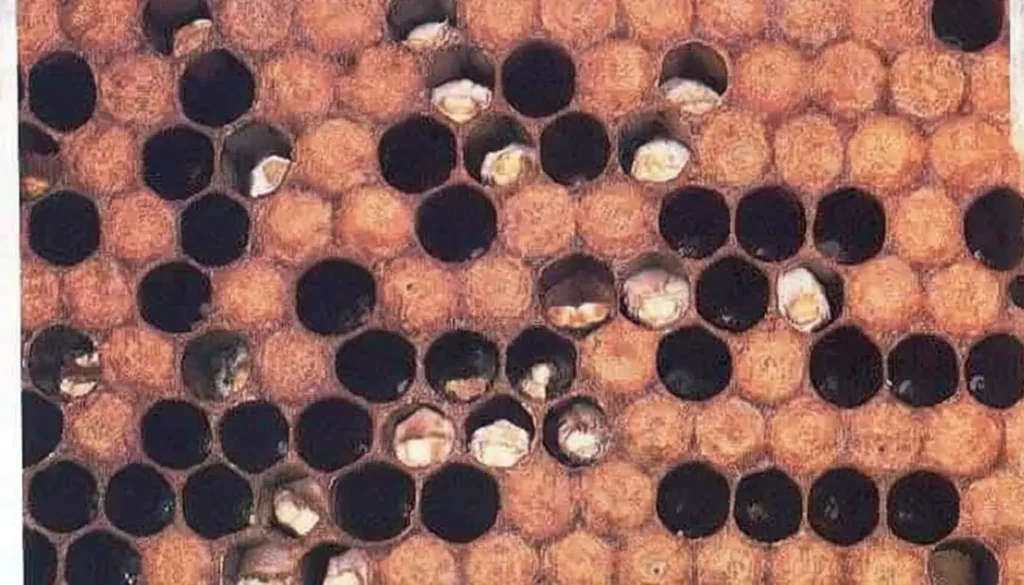 Taş Hastalığı Nasıl Tedavi Edilir?